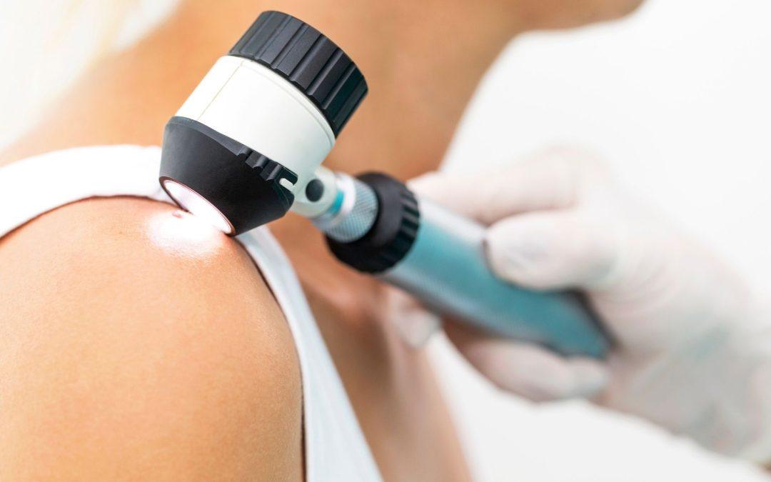 Skin Cancer Treatment in Myrtle Beach