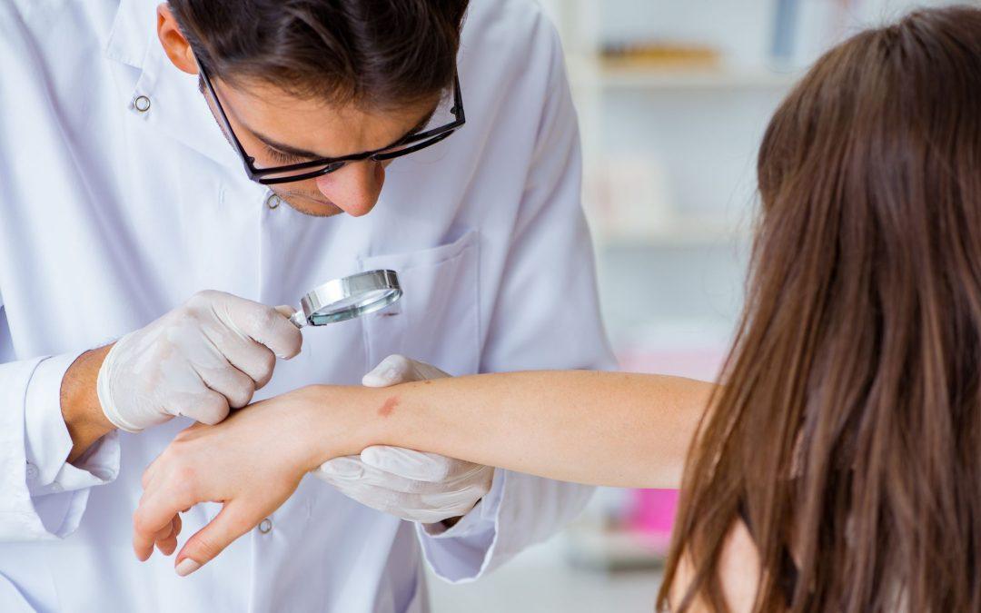 Skin Cancer Screening Procedure: What to Expect