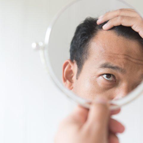 Mane Concerns: Understanding Hair Loss